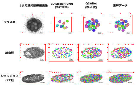 共同発表】生殖補助医療につながる革新的AI開発に成功－不妊症の
