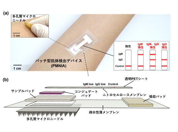 新型コロナウイルス感染症の無痛・迅速診断パッチの開発-1.jpg